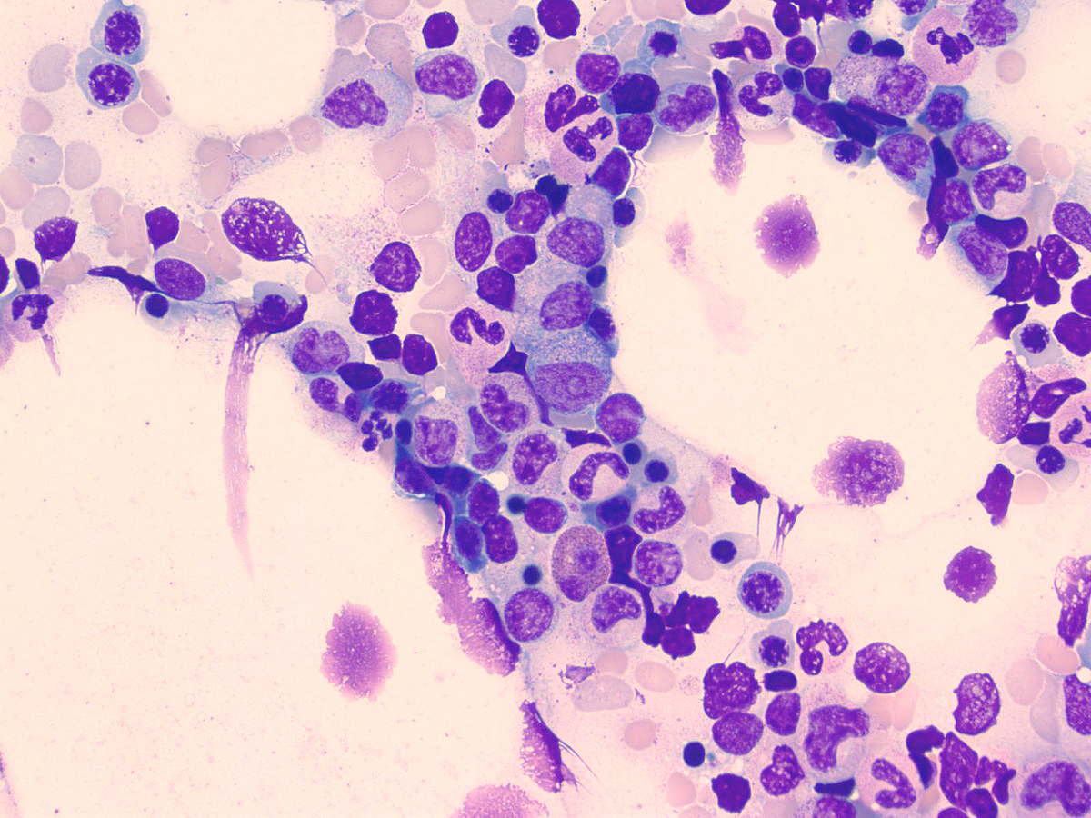 Image 5 aspirate 50x